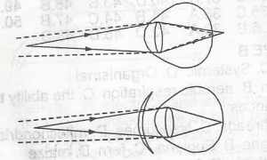 The function of the correcting lens is to